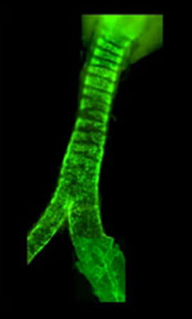 Patterns of GFP labeling in the trachea.